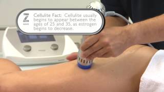 ZWave for Cellulite - Thighs Treatment