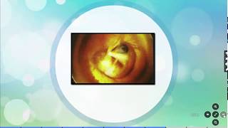 مراحل تحول جنين البيضة الى دجاجة - Chicken Embryo Development