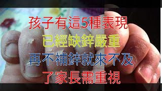 孩子有這5種表現，已經缺鋅嚴重，再不補鋅就來不及了家長需重視