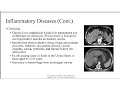 radiographic pathology of the hepatobiliary system