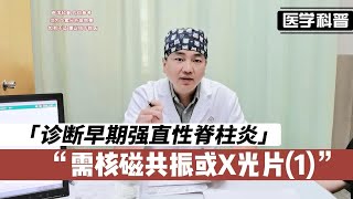 诊断早期强直性脊柱炎一般需要什么呢？需要核磁共振或X光片(1)