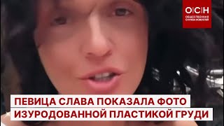 Певица Слава показала фото изуродованной пластикой груди