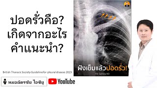 ปอดรั่ว ลมรั่วในช่องเยื่อหุ้มปอด คืออะไร #ปอดรั่ว #ห้ามดำน้ำ #ห้ามขึ้นเครื่องบิน