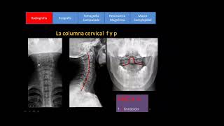 UCC - Diagnóstico por Imágenes - Osteoarticular normal