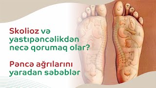 Yeriməkdə belə çətinlik yarada bilən - #Pəncə ağrıları. Əsas səbəblər? - Nevroloq