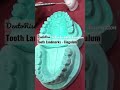 Landmarks on tooth surfaces |CINGULUM | Tooth landmarks |Dental Anatomy Short video yt