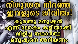 രൂപത്തിന്റെ പേരിൽ സമൂഹത്തിനെ പരിഹാസങ്ങൾ ഏറ്റുവാങ്ങേണ്ടി വന്ന ഒരു പാവം സ്ത്രീ.