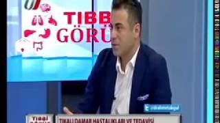 BACAK DAMAR TIKANIKLIĞI TANISI NASIL KONUR ? / PROF DR AHMET AKGÜL