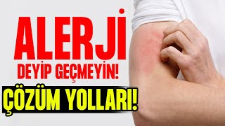 Alerji Deyip GEÇMEYİN! Alerjik Reaksiyonların Nedenleri Ve ÇÖZÜM YOLLARI! | Doktor Fitt