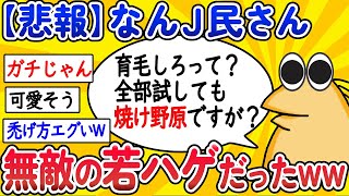 【2ch面白いスレ】【悲報】なんJ民さん、無敵の若ハゲだったwww【ゆっくり解説】