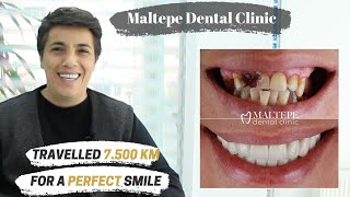 Full Mouth Restoration | Maltepe Dental Clinic, Istanbul / Turkey