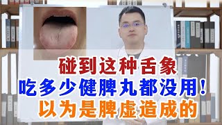 碰到这种舌象，吃多少健脾丸都没用