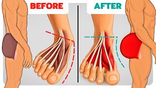 How Strong Glutes Fix Flat Feet & Weak Ankles (Science-Based)