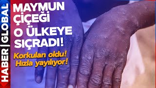 Korkulan Oldu! Maymun Çiçeği Virüsü Afrika'dan Çıktı, O Ülkeye Sıçradı