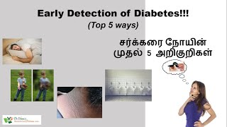 Early detection of type 2 diabetes| நீரிழிவு நோயின் முதல் 5 அறிகுறிகள்| Day 4/100