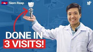 Get Dental Implants in Siem Reap: A Prosthodontist in Cambodia Breaks It Down!