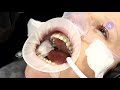 four procedures to transform your smile