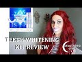 Genius Labs teeth whitening kit review: Before & After