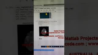 Brain tumor detection and classification using deep learning in python