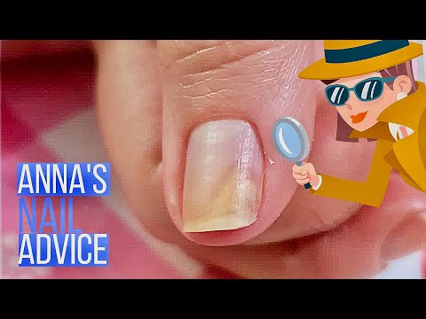 How can I manage nail problems?