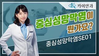 중심성망막염이 뭔가요? | 중심성망막염 정의, 원인, 증상 | 중심장액맥락망막병증 | 망막질환 | 안과질환 | 카이안과TV