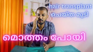 Hair transplantation after 20 days | ഇത്ര ദിവസം കൊണ്ട് മുടിക്ക് വന്ന മാറ്റം | safvan pullara