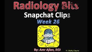 RADIOLOGY BITS (SNAPCHAT WEEK 26)