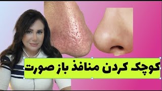 کوچک کردن منافذ باز پوست صورت یا پوست پرتقالی