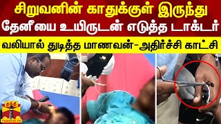 சிறுவனின் காதுக்குள் இருந்து தேனீயை உயிருடன் எடுத்த டாக்டர்..வலியால் துடிதுடித்த மாணவன் | Vellore