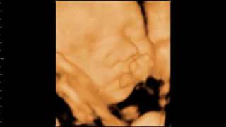 Angel Prints 4D - Specializing in Elective 4D Ultrasound