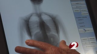 Greene County Jail gets body scanner