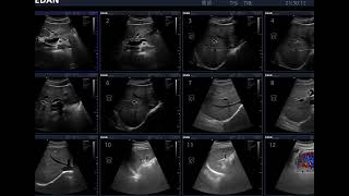 Edan ultrasound Acclarix Image Gallery