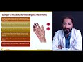 vascular system vasculitis syndromes