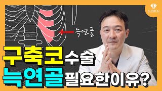 구축코수술 시 왜 늑연골을 사용해야 할까요?