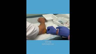 MoraMD: Painless Elbow Olecranon Bursitis Fluid Removal