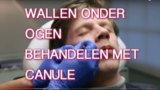 WALLEN ONDER OGEN LATEN BEHANDELEN MET CANULE | FURROW.NL