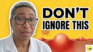 "7 Reasons Why You Need to Pay Attention to Vulval/Vaginal Lumps!"