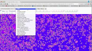imagejs ki67 module for a pathology application