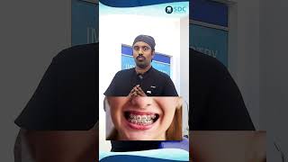 Will Invisalign Affect My Oral Hygiene | Invisalign எனது வாய்வழி சுகாதாரத்தை பாதிக்குமா? Dr.MKP