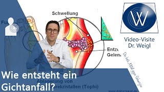 Gicht 😡 Oft unterschätzt aber sehr schmerzhaft: Akuter Gichtanfall - Ursachen, Symptome & Therapie