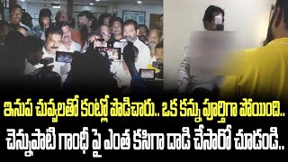 ఇనుప చువ్వలతో కంట్లో పొడిచారు. ఒక కన్ను పూర్తిగా పోయింది. గాంధీ పై ఎంత కసిగా దా-డి చేసారో చూడండి