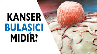 Kanser Bulaşıcı Bir Hastalık mıdır?