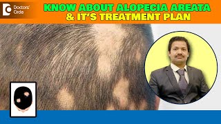 ALOPECIA AREATA | Patchy Hair Loss - Triggers & Treatment - Dr Deepak P Devakar