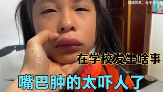 9岁侄女嘴巴肿的吓人，在学校发生了啥？得知原因让人哭笑不得