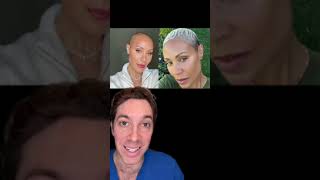 Jada Smith's Battle with Alopecia Areata