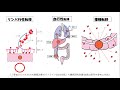 大腸がんの手術について～大腸がんなんてこわくない～