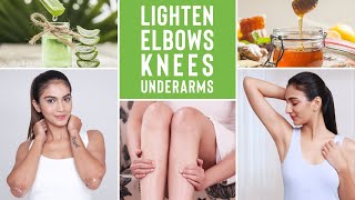 Brighten Dark Patches on Elbows & Knees & Underarms | Home Remedies To Reduce Pigmentation