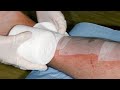 Daytime wounds 'heal more quickly'