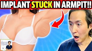 Shocking But True Plastic Surgery Stories