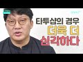 의느님답변📂ㅣ모발이식수술 전 후 사진 눈속임에 절대 속지마세요 의느님답변 107회